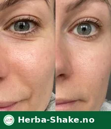 Herbalife Collagen Skin Booster – forbedrer hudens elastisitet